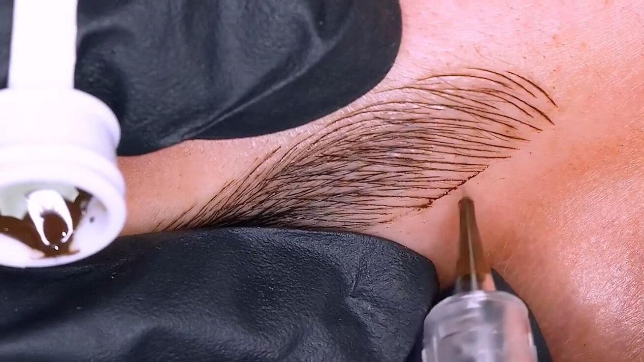 תמונה של מיקרובלדינג בפעולה